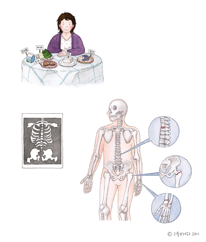 GSK_본비바/골다공증환자 안내책자